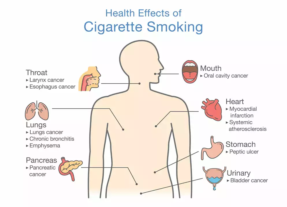 How Smoking Affects Your Risk of Developing Stomach Ulcers