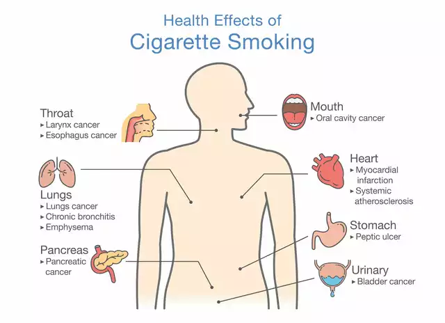 How Smoking Affects Your Risk of Developing Stomach Ulcers